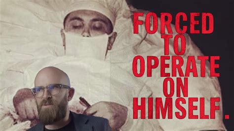 The Man Who Removed His Own Appendix .